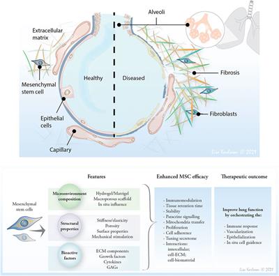 Harnessing the ECM Microenvironment to Ameliorate Mesenchymal Stromal Cell-Based Therapy in Chronic Lung Diseases